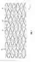 Fig. 02 - Coating for medical device having increased surface area