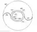 Fig. 01 - Method for creating incisions to improve intraocular lens placement