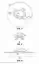 Fig. 06 - Method for creating incisions to improve intraocular lens placement