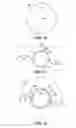 Fig. 07 - Method for creating incisions to improve intraocular lens placement