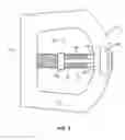 Fig. 03 - Intervertebral implant with fixation mechanism