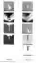 Fig. 22 - Probes for enhanced magnetic force microscopy resolution
