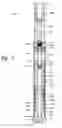 Fig. 06 - Percussion drilling assembly with annular locking member