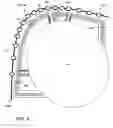 Fig. 08 - REAL TIME DULL GRADING