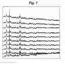Fig. 09 - CAPILLARY ELECTROPHORESIS FLUORESCENT DETECTION SYSTEM