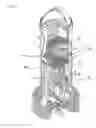 Fig. 02 - Mechanical assembly for securing the structural integrity of a pipe joint