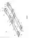 Fig. 02 - Support means for assisting in hauling an item