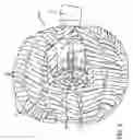 Fig. 04 - Buffing ball made of compressible material