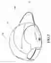 Fig. 04 - Illuminated cap having optical fiber strand and removable pouch