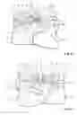 Fig. 06 - Hearing device with user control