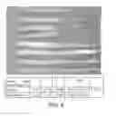 Fig. 09 - Treating atherosclerosis