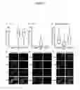 Fig. 02 - Methods and compositions for the treatment of antibody mediated neuropathies