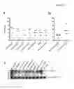 Fig. 06 - Expression of FoxP3 by cancer cells