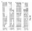 Fig. 07 - HUMAN VASCULAR ENDOTHELIAL GROWTH FACTOR 2