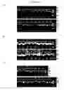 Fig. 09 - Antibodies Specific for Rubella Virus