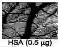 Fig. 01 - Methods of reducing angiogenesis of age-related macular degeneration (AMD) or choroidal neovascularization by an anti-carboxyetheylpyrrole (CFP) antibody