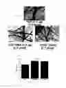 Fig. 02 - Methods of reducing angiogenesis of age-related macular degeneration (AMD) or choroidal neovascularization by an anti-carboxyetheylpyrrole (CFP) antibody