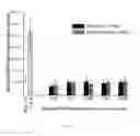 Fig. 06 - Methods of reducing angiogenesis of age-related macular degeneration (AMD) or choroidal neovascularization by an anti-carboxyetheylpyrrole (CFP) antibody