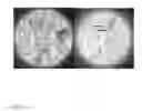Fig. 02 - CAPTURE OF MYCOBACTERIA LIKE MICRO-ORGANISMS