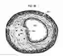 Fig. 05 - Methods and compositions to treat myocardial conditions