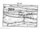 Fig. 07 - Methods and compositions to treat myocardial conditions