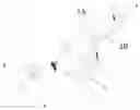 Fig. 01 - Biocompatible rapid-gelating hydrogel and associated preparation method of spray