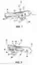 Fig. 02 - Ear clip with pole