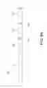 Fig. 08 - MAGNETIC DEVICE FOR GUIDING CATHETER AND METHOD OF USE THEREFOR