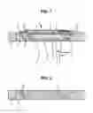 Fig. 02 - Surgical method for implanting a housing-interface assembly in a bone wall
