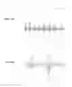 Fig. 11 - Method for measuring central venous pressure or respiratory effort