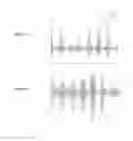 Fig. 13 - Method for measuring central venous pressure or respiratory effort