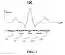 Fig. 02 - ANALYZING ALTERNANS FROM MEASUREMENTS OF AN AMBULATORY ELECTROCARDIOGRAPHY DEVICE