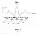 Fig. 02 - ALTERNANS AND CARDIAC ISCHEMIA