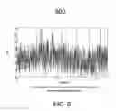 Fig. 07 - ALTERNANS AND CARDIAC ISCHEMIA