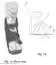 Fig. 02 - Total Contact Windowed Slipper with a Lid