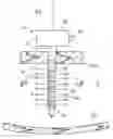 Fig. 01 - Trocar sleeve