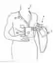 Fig. 01 - Portable breastpump