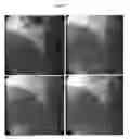 Fig. 02 - METHOD FOR LOADING STRUCTURED SURFACES