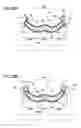 Fig. 23 - Absorptive article