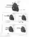 Fig. 03 - Loop Ablation Apparatus and Method