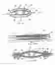 Fig. 17 - Loop Ablation Apparatus and Method