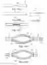 Fig. 23 - Loop Ablation Apparatus and Method