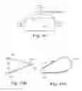 Fig. 25 - Loop Ablation Apparatus and Method