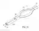 Fig. 30 - Loop Ablation Apparatus and Method