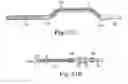 Fig. 41 - Loop Ablation Apparatus and Method
