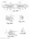 Fig. 50 - Loop Ablation Apparatus and Method
