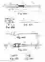 Fig. 51 - Loop Ablation Apparatus and Method