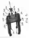 Fig. 67 - Loop Ablation Apparatus and Method
