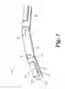 Fig. 02 - Bone fixated, articulated joint load control device