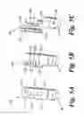 Fig. 06 - Bone fixated, articulated joint load control device